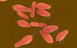 肉毒杆菌是什么，肉毒杆菌是什么东西