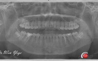 系带在哪，系带在哪个位置